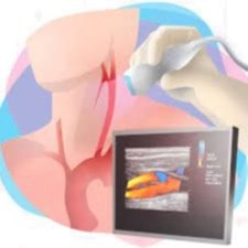 Foto de San Lucas Ecodoppler Vasos Y Miembros Inf