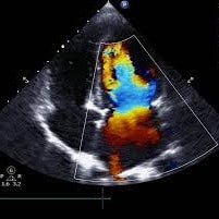 Foto de San Lucas Ecocardiograma Doppler