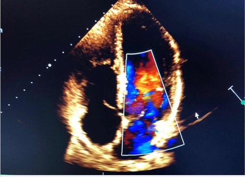 Foto de Isabel  Masuda, Cardiología Adultos