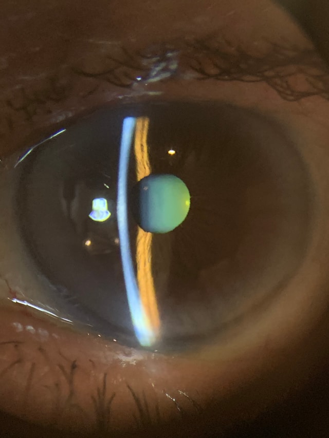 Foto de Leonardo Pérez Morales, Oftalmología